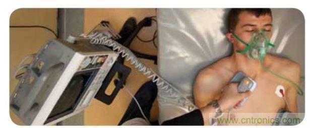 帶電極的醫(yī)院用除顫器。注意，患者身上有外部心電圖或心臟監(jiān)護(hù)儀，從胸部的白色圓片(電極)和導(dǎo)聯(lián)(線)可看出來。