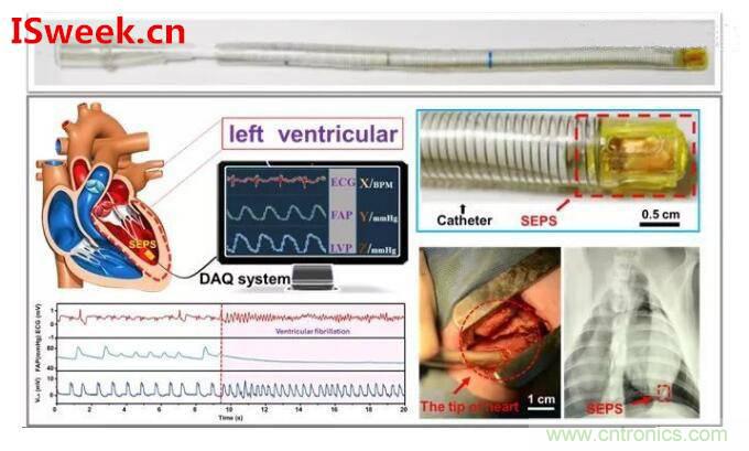 詳解光纖壓力傳感器在心內(nèi)壓評估的應(yīng)用 詳解光纖壓力傳感器在心內(nèi)壓評估的應(yīng)用