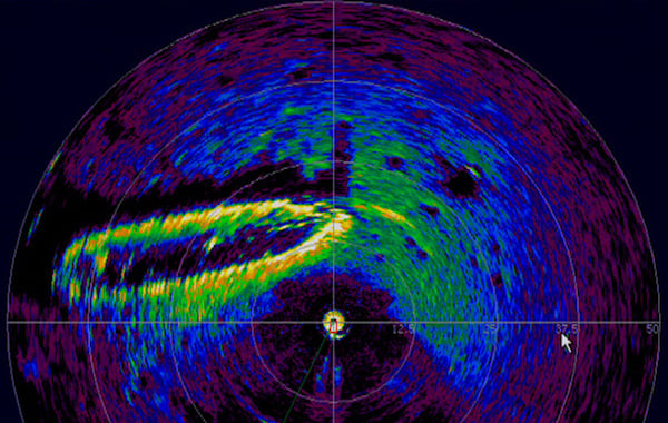 什么是激光雷達(dá)以及如何使用它？
