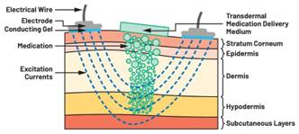 圖5.人體皮膚分層橫截面以及TMD和生物阻抗測量  考慮到生物阻抗分析的無創(chuàng)性，使用兩個金屬電極代表電氣傳感器，連接模擬前端(AFE)電路和患者皮膚。這個金屬與非金屬的接觸點是構成整個電路的另一個關鍵部分，連接了AFE和人體電氣模型。電荷載體（電極中的電子和人體內的離子）之間的相互作用可能對這些傳感器的性能產(chǎn)生重大影響，需要根據(jù)每種應用進行具體考慮。首先，金屬與離子溶液接觸的相互作用導致金屬表面附近溶液中離子濃度的局部變化。這種現(xiàn)象會改變電極下方區(qū)域的電荷中性，導致金屬周圍的電解質電位與溶液其余部分不同，從而在金屬和電解質主體之間產(chǎn)生一個電位差，即常說的“半電池電位”。其次，注入電流的直流分量會導致電極極化。  表1.各種電極類型和相應的半電池電位  金屬及反應  半電池電位(V)  Al → Al3+ + 3e- Al → Al3+ + 3e-  –1.706 –1.706  Ni → Ni2+ + 2e- Ni → Ni2+ + 2e-  –0.230 -0.230  H2 → 2H+ + 2e- H2 → 2H+ + 2e-  0.000 (by definition) 0.000（根據(jù)定義）  Ag + Cl- → AgCl + e- Ag + Cl- → AgCl + e-  +0.223 +0.223  Ag → Ag+ + e- Ag → Ag+ + e-  +0.799 +0.799  Au → Au+ + e- Au → Au+ + e-  +1.680 +1.680  這是一種不良現(xiàn)象，往往導致電極性能下降。這些考量表明，電極也需要定義適當?shù)碾姎饽Ｐ停▍⒁妶D6）。我們可以將干電極表示為具有三個串聯(lián)元件的電路：一個用于模擬半電池電位(EHC)的直流電源；一個用于模擬金屬和非金屬（人體）之間接觸的RC并聯(lián)電池(Rd||Cd)；以及一個用于模擬電極金屬的電阻Rs。